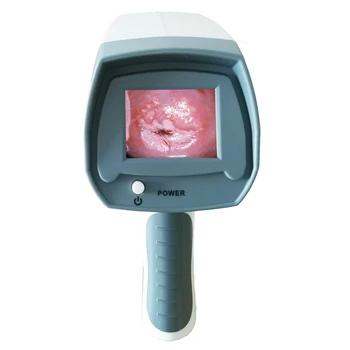 Видеоэндоскоп с оптимално зрение, инструмент за вагината, цифров кольпоскоп за вагинално ендоскоп